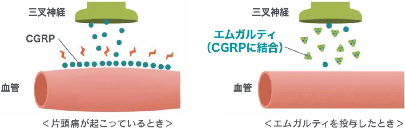 エムガルティの投与効果