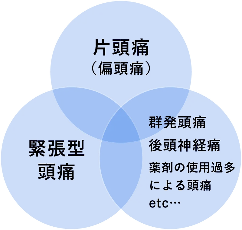 一次性頭痛の種類